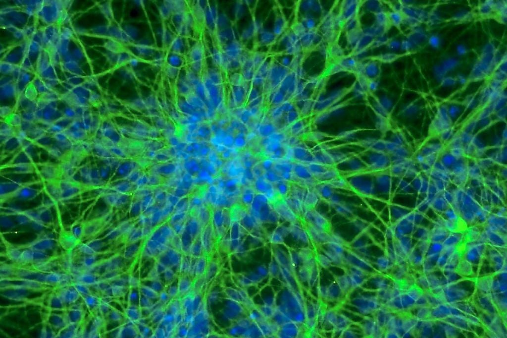 Wissenschaftler halten den Atem an