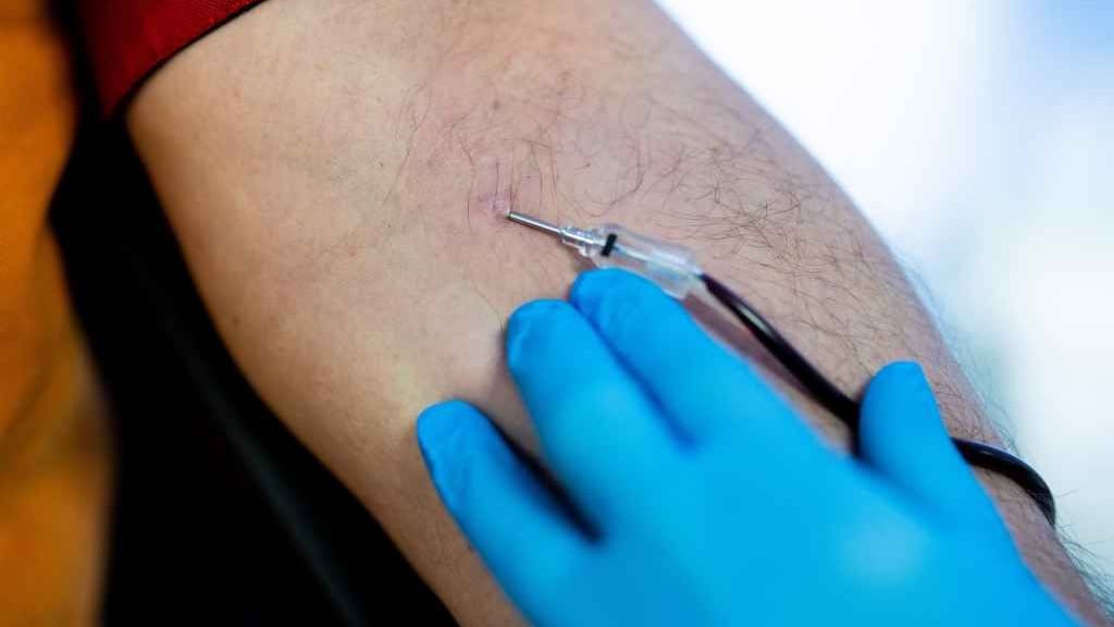 Leipzig/Münster Heilpraktiker dürfen kein Blut abnehmen